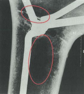 Röntgenbild des maroden Flossis